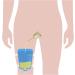 Urinary Catheter Kit - 5 Day External Self-Seal Condom Catheters + Leg Bag 750ml + Straps - XLarge 35mm (1.37 Inches) - 5.9 inch Tube - Buy Online on GoSupps.com