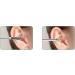 Spring Earwax Cleaner Tool Set- 6-in-1 Ear Pick Kit for Ear Wax Removal - Reusable Ear Cleaner for Acne & Wart Removal - Buy Online on GoSupps.com