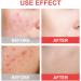 Buy Invisible Acne Patches - 144 Hydrocolloid Stickers for Face & Body | Effective Acne Treatment - International Shipping - Buy Online on GoSupps.com