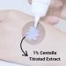 Medicube Red Centella Balm 30g | 1% Centella Titrated Extract | After Breakout Care | Korean Skincare - Buy Online on GoSupps.com