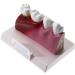 PSVOD 4x4 Anatomy Models for Dental Diseases | Educational Tools for Oral Care & Teaching - Buy Online on GoSupps.com