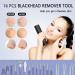 Xesscare 16 Pcs Pimple Popper & Blackhead Remover Tool Kit - Professional Acne Extraction Set with Metal Case - Purple - Buy Online on GoSupps.com