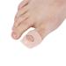 1 pair of ingrown toenail corrector elastic silicone-toen nail clip pain relief paronychie correction tool healthy nails toenail correction patch for men and women