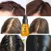 RtopR Moroccan Hair Essential Oil for Hair Loss Prevention - Dry Damaged Hair Care for Men and Women - Healthier Scalp Treatment for Shine and Gloss - Buy Online on GoSupps.com