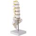 Buy Lumbar Model Utensil Tool for Spine - Essential Lumbar Spine Model & Back Braces | International Shipping Available - Buy Online on GoSupps.com