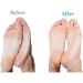 Buy Emjoi Micro-Pedi Callus Remover (Lilac) - Best Foot Care Solution for Smooth Feet - Fast International Shipping - Buy Online on GoSupps.com