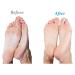 Emjoi Micro-Pedi Refill Rollers (Extra Coarse) - Pack of 4 | For Smooth and Soft Feet - Buy Online on GoSupps.com