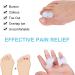 Soft Toe Separator & Gel Toe Caps - 8 Pack Hallux Valgus Spreader for Optimal Toe Protection & Correction - Buy Online on GoSupps.com