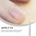 Dajidafu Nail Cuticle Pusher Art Stainless Steel Manicure Edge Remover Handle Reusable Toenail Reusable Salon Pedicure Removing - Buy Online on GoSupps.com