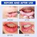 Oral Relief Spray - Canker & Dry Mouth Relief | Moisturizing Oral Care Spray - Buy Online on GoSupps.com