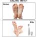 Vokmon Pedicure Hornhauter Set - Professional Foot File with Replacement Blades for Effective Hard Skin Removal | Perfect for Foot & Hand Care - Buy Online on GoSupps.com
