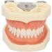 Upper Jaw Cyst Dental Model - Soft Gum 28 Teeth Practice Frame for Abscessing (International Shipping) - Buy Online on GoSupps.com
