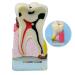 Dytah dental implant model - tooth pathology model - analysis crown bridge demonstration teeth model parodontal sortal teeth gums dental care for education