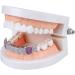 Wudaizhi Hip Hop Grill Premium Gold Plated Grillz for Trendy Style | International Shipping Available - Buy Online on GoSupps.com