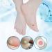 Wart Remover Corn Remover Foot Corn Remover Pads Plantar Wart Removal Corn Callus Remover Penetrates and Removes Common and Plantar Warts Callus Stops Wart Regrowth 20PC - Buy Online on GoSupps.com