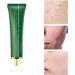 acne removal cream Acne Scar Removal Gel Face Body Marks Skin Repair Cream Acne Treatment Essence 30g - Buy Online on GoSupps.com