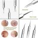 Usiveinborn Blackhead Remover Usiveinborn Usiveinborn Tweezers Usiveinborn Stainless Stainless Steel Facial Blackhead Remover Tweezers with Iron box (4 Pcs) - Buy Online on GoSupps.com