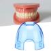 5-Piece Mouth Opener Set | Oral Lip Holder for Dental Practices & Tooth Lighting Salons - Blue Transparent - Buy Online on GoSupps.com