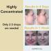 Rebel Skin Care Face Serum for Blemishes & Scars - All Natural 15ml Oil for Women & Men Acne Spot Reducer - Made in USA - Buy Online on GoSupps.com