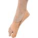 Flbirret 2Pcs Ultra-Thin Bunion Corrector Sleeves - Toe Splint Brace for Foot Pain Relief and Valgus Correction - Buy Online on GoSupps.com