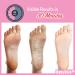 BabySkin Ultimate Foot Peeling Mask - Exfoliating Spa Scrub for Cracked Heels Dead Skin & Calluses - Shop Internationally - Buy Online on GoSupps.com