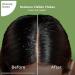 Pilgrim Australian Tea Tree Anti-Dandruff Shampoo 200ml | Non-Drying Soothes Itching & Irritation for Men & Women - Buy Online on GoSupps.com