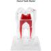 Discriminable Toothed Tooth Model for Endodontics | Plastic Teeth Teaching Material for Dental Studies & Research | International Shipping Available - Buy Online on GoSupps.com