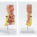Human Anorectal Pathology Model Hemorrhoid Lesion Model Hemorrhoid Anal Fistula Lesion Model Rectal Medical Education/Product Education - Buy Online on GoSupps.com