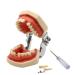 Ernzi in the model for training in dentistry demonstration teaching teeth teeth dental model from adult - -broadcasting screwdrivers removable