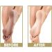 ProLinc Callus Eliminator 4 Fluid Ounce - Buy Online on GoSupps.com
