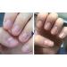 Biancat OnyxoGuard Nail Growth and Repair Serum OnyxoGuard Serum Nail Growth Serum Nail Growth and Strengthener Nail Serum Repair Essence Nail Strengthener for Thin Nails and Growth (2pcs) - Buy Online on GoSupps.com