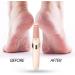 Rechargeable Electric Foot File Professional Callus Remover Portable Foot Scrubber Pedicure Tool for Silky Feet - Buy Online on GoSupps.com
