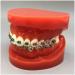 Orthodontic Teeth Model Dental Typodont with Metal Brackets & Ligature Ties - Red | International Shipping Available - Buy Online on GoSupps.com