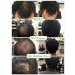 Black Hair Building Fibers - Hair Loss Concealer Powder for Thicker Hair - 0.77oz - For Women and Men - Buy Online on GoSupps.com