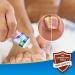 Fungal Nail Treatment Cream - Antifungal Solution for Toenail Repair & Discolored Nails - Buy Online on GoSupps.com