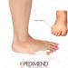 Buy Pedimend Silicone Gel Pinky Foot Alignment Separator | 6 Pieces for Pain Relief | Original Tailoring Bale Corrector & Protection Film - Buy Online on GoSupps.com