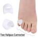 Buy Silicone Toe Separator & Hallux Valgus Adjuster - Bone Ectropion Outer Appliance for Pain Relief | International Shipping - Buy Online on GoSupps.com