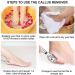 Luoileily Pedicure Foot Rasp & Callus Shaving Kit - 20 Blades Professional Foot Care Scraper for Dead Skin & Hard Skin Remover - Buy Online on GoSupps.com