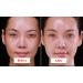 ULTIMATE Stem Cell + PDRN Healing Booster Overnight Serum | Reduce Wrinkles & Discoloration - 10ml x 5 Vials | Buy Internationally - Buy Online on GoSupps.com