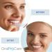 LumiSmiles Dissolving Whitening Strips - 10% Hydrogen Peroxide - 14 Treatments - Lumineers - Buy Online on GoSupps.com