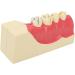 High Simulation Decomposition Model of Posterior Teeth 2x Magnification Educational Aid for Dental Studies - Buy Online on GoSupps.com