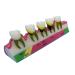 Dytah dental model dental teeth lessons for the standard demonstration for adult standard demonstration model periodontitis periodontital disease classification for studies and teaching