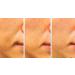 WhiteSilk Power Ampule with Stem Cell Complex, Bakuchiol, Vitamin C, and Melatonin - 10ml x 5 vials - Buy Online on GoSupps.com