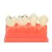 Ververt Touch toothing model dental caries model for school dental lessons demonstration model learning aid for dentists 180 mm