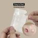 Spot Covering Patch M 150CT | Hydrocolloid Acne Pimple Patches - Ultra Thin Invisible Spot Patch for Face & Skin - Buy Online on GoSupps.com