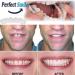 Flipped Warm Dentures - 2 Pairs of Plug-In False Teeth | Cosmetic Temporary Artificial Teeth - Buy Online on GoSupps.com