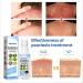 Meellop Herbal Psoriasis, Eczema, Vitiligo Relief Spray - Skin Repair, Stop Burning & Itching (5Pcs) - Buy Online on GoSupps.com