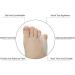 Pedimend Tailor Hallux Valgus Corrector - Silicone Gel Foot Support with Toe Spreader - 5 Pairs for Flat Feet Relief and Bunion Protection - Buy Online on GoSupps.com