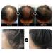 Fast Hair Growth Serum | Prevent Hair Loss & Thinning | Targets Alopecia & Hairline Issues | Postpartum & Seasonal Care Oil - Buy Online on GoSupps.com