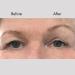 Instant Browlifts - Eyebrow Lift Strips & Anti-Wrinkle Tape | 30-Day Supply for Perfect Brows - Buy Online on GoSupps.com